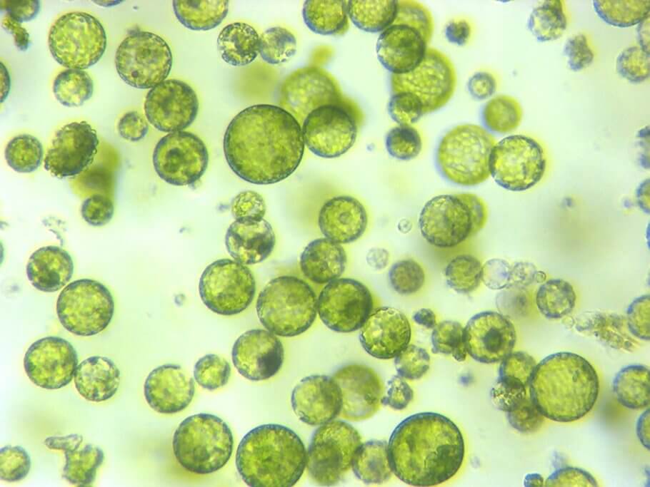 A photomicrograph of an isolated plant protoplast cell for use in a biotechnology CRISPR technology experiment